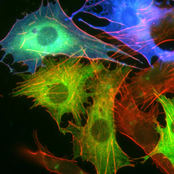 Heavily enhanced image of cells in immunofluorescence.